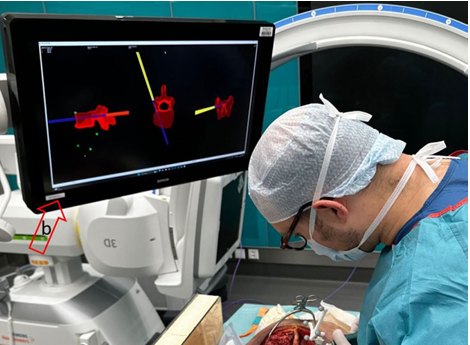 X23D spine navigation model reproduced in the feasibility study